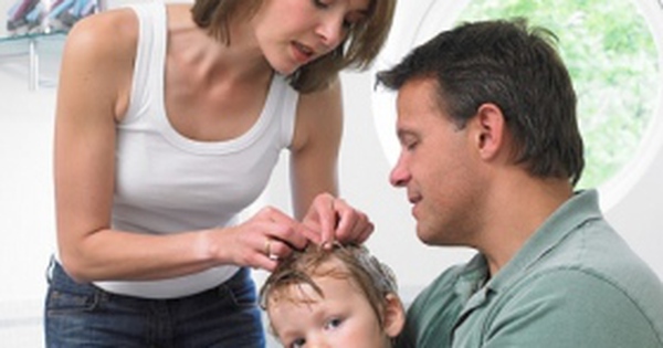 Có những biện pháp phòng tránh tái nhiễm nấm da đầu ở trẻ em như thế nào?