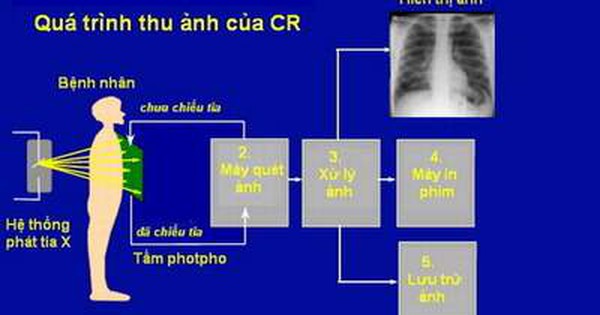 Những điều thú vị về tia X