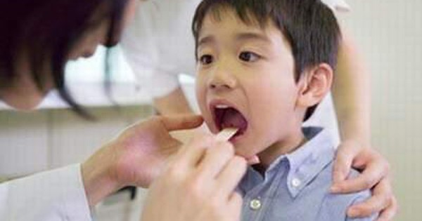 Tình trạng khô miệng và họng kéo dài có thể gây viêm họng và sốt tại sao?
