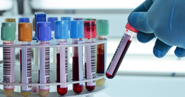Chỉ số HgB trong kết quả xét nghiệm máu có ý nghĩa gì?
