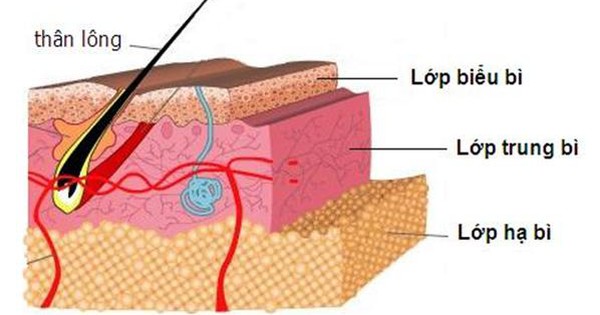  Mụn thịt u tuyến mồ hôi - Phương pháp hiệu quả để đánh tan nỗi lo về mụn mông của bạn