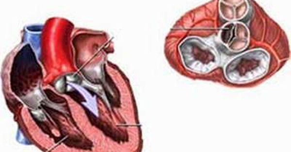 MÔ HÌNH TIM PHỔI VÀ CÁC MẠCH MÁU LỚN