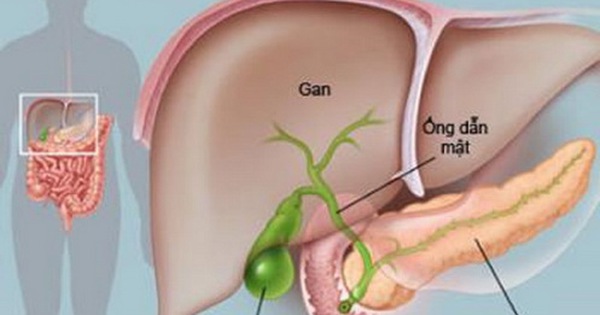 Viêm tụy cấp có thể gây biến chứng nào?
