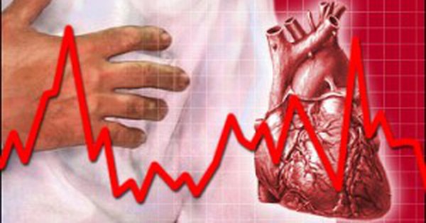 Điện tâm đồ là phương pháp nào dùng để chẩn đoán tình trạng tim đập nhanh khi nằm xuống?
