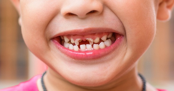 Cơ chế hoạt động của men răng và vai trò của men răng đối với răng sữa?
