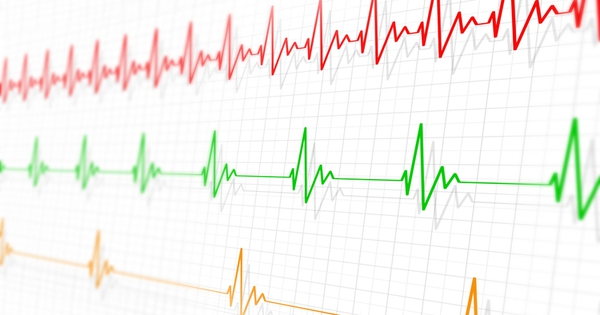 Nhịp tim 45 lần/phút có ảnh hưởng gì đến sức khỏe?