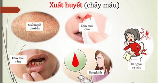 3. Triệu chứng và dấu hiệu cảnh báo