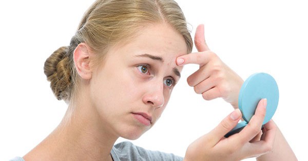 Tìm hiểu nội tiết tố ảnh hưởng đến làn da tuổi dậy thì như thế nào?