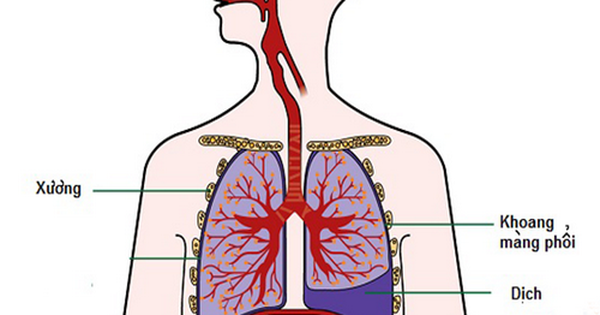 Biến chứng của bệnh lao phổi là gì?
