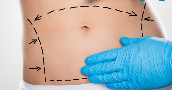 What are the different shapes and types of scars that can occur after abdominal fat removal?