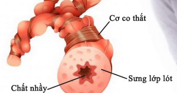 Bệnh nhân hen suyễn có cần thường xuyên kiểm tra và theo dõi sức khỏe không?