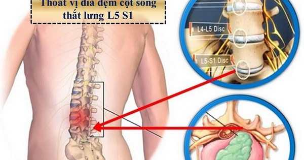 Phương pháp xoa bóp đau lưng hiệu quả cho cơ thể bạn