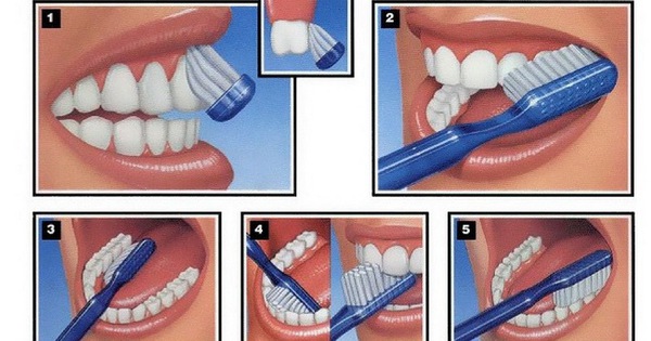 Lợi khỏe có màu sắc và dấu hiệu như thế nào?
