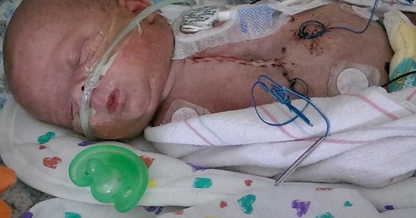 Kỳ tích: Ghép tim cho bé sơ sinh 6 ngày tuổi