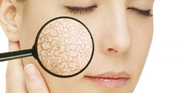 Vitamin nào có tác dụng quan trọng đối với làn da và giúp khắc phục tình trạng da khô?
