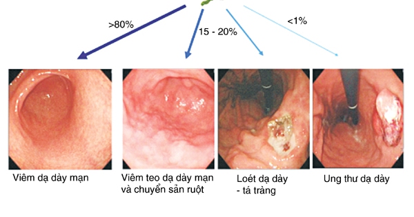 3. Các Triệu Chứng Và Dấu Hiệu Nhận Biết