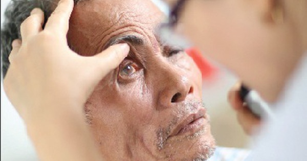 Cách phòng ngừa sốt xuất huyết để tránh đau hốc mắt? 
