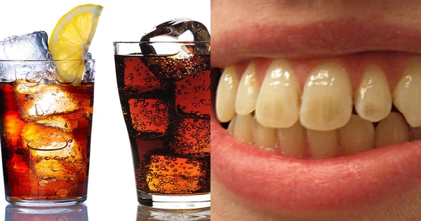 Răng xuất hiện đốm trắng có thể gây ra sự khó chịu hay đau nhức không?
