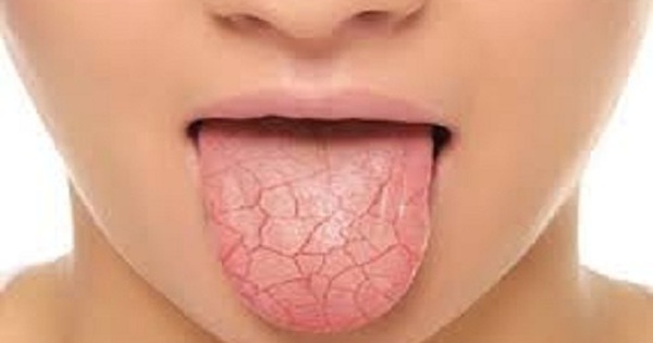Trường hợp nào nên đi khám bác sĩ khi gặp phải đau rát trong khoang miệng trên?
