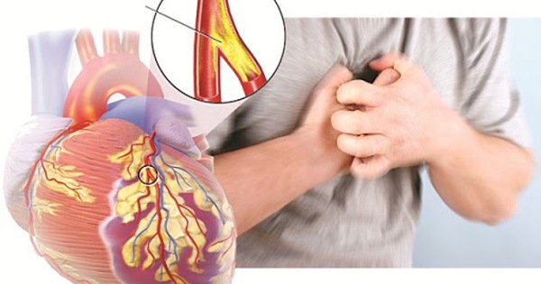 Tổn thương từ khoang bụng có thể gây đau vùng dưới xương ức?
