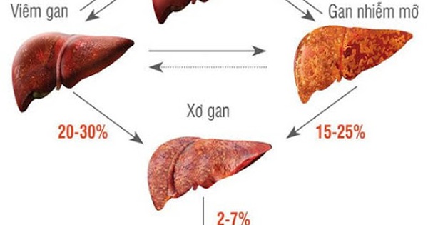 Nguyên nhân gây ra chảy máu thực quản là gì?
