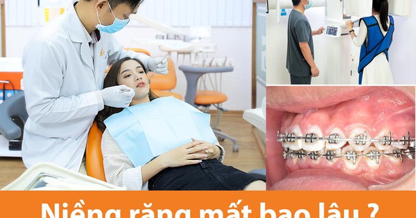 Quá trình gắn mắc cài niềng răng có đau khó chịu không?
