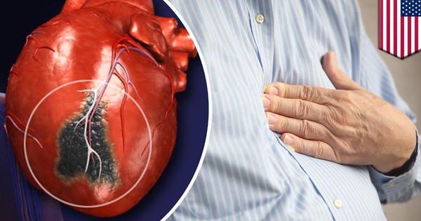 Làm thế nào để phát hiện và chẩn đoán thiếu máu cơ tim thầm lặng?
