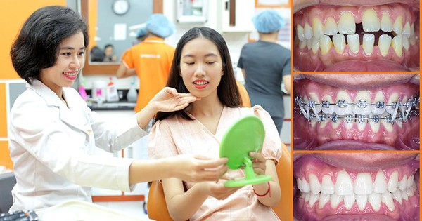 What are the legal rights and responsibilities stated in the Hợp đồng niềng răng regarding dental braces?