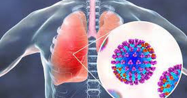 U nấm phổi có thể gây ra biến chứng nào khác không?
