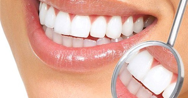 Có cần chú ý đến việc chăm sóc răng miệng hàng ngày khi đang thực hiện cách làm trắng răng tự nhiên?
