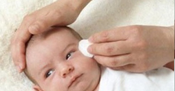 Cách trị chảy nước mắt sống ở trẻ sơ sinh là gì?