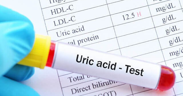 Các phương pháp tự nhiên để giảm lượng axit uric trong máu là gì?
