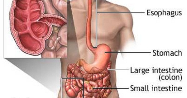 Làm thế nào để chẩn đoán bệnh Crohn?
