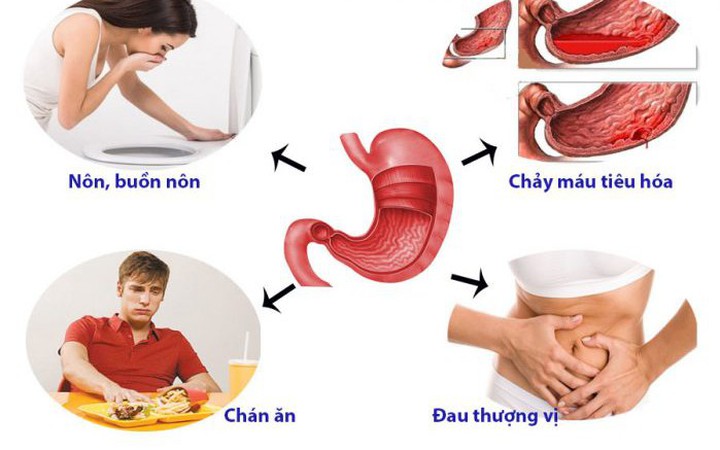 dấu hiệu của đau dạ dày - Báo Sức khỏe & Đời sống - Cơ quan ngôn luận của Bộ Y tế
