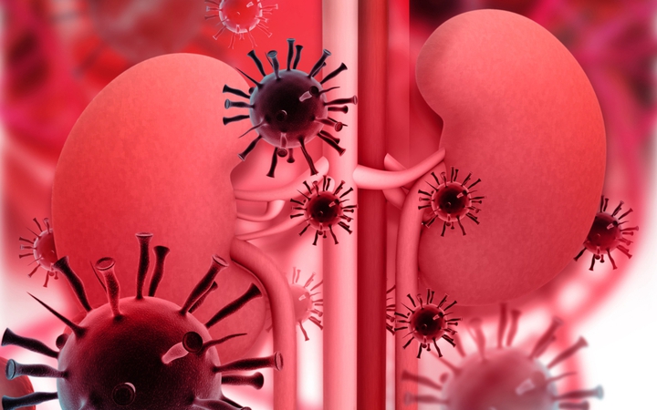 Nguyên nhân gây bệnh thận do HIV thường liên quan đến tải lượng virus cao 