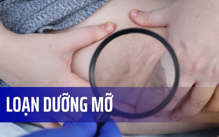 Loạn dưỡng mỡ: Nguy&#234;n nh&#226;n, triệu chứng, c&#225;ch điều trị v&#224; ph&#242;ng bệnh