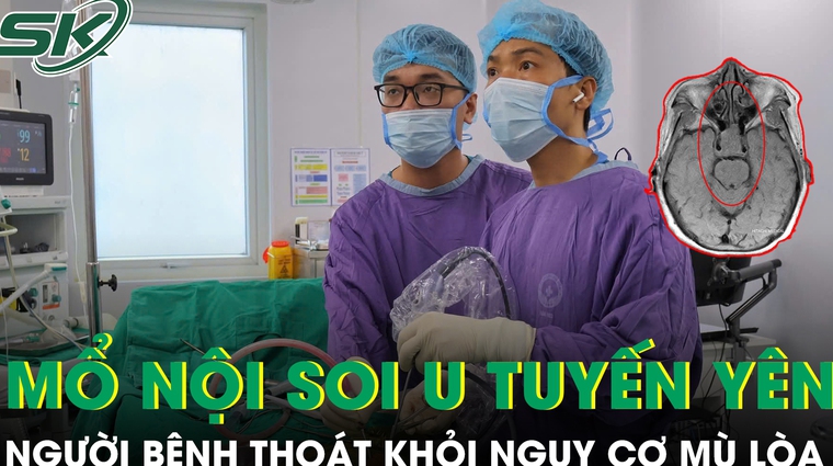 Thoát khỏi nguy cơ mù lòa nhờ phẫu thuật nội soi u tuyến yên 